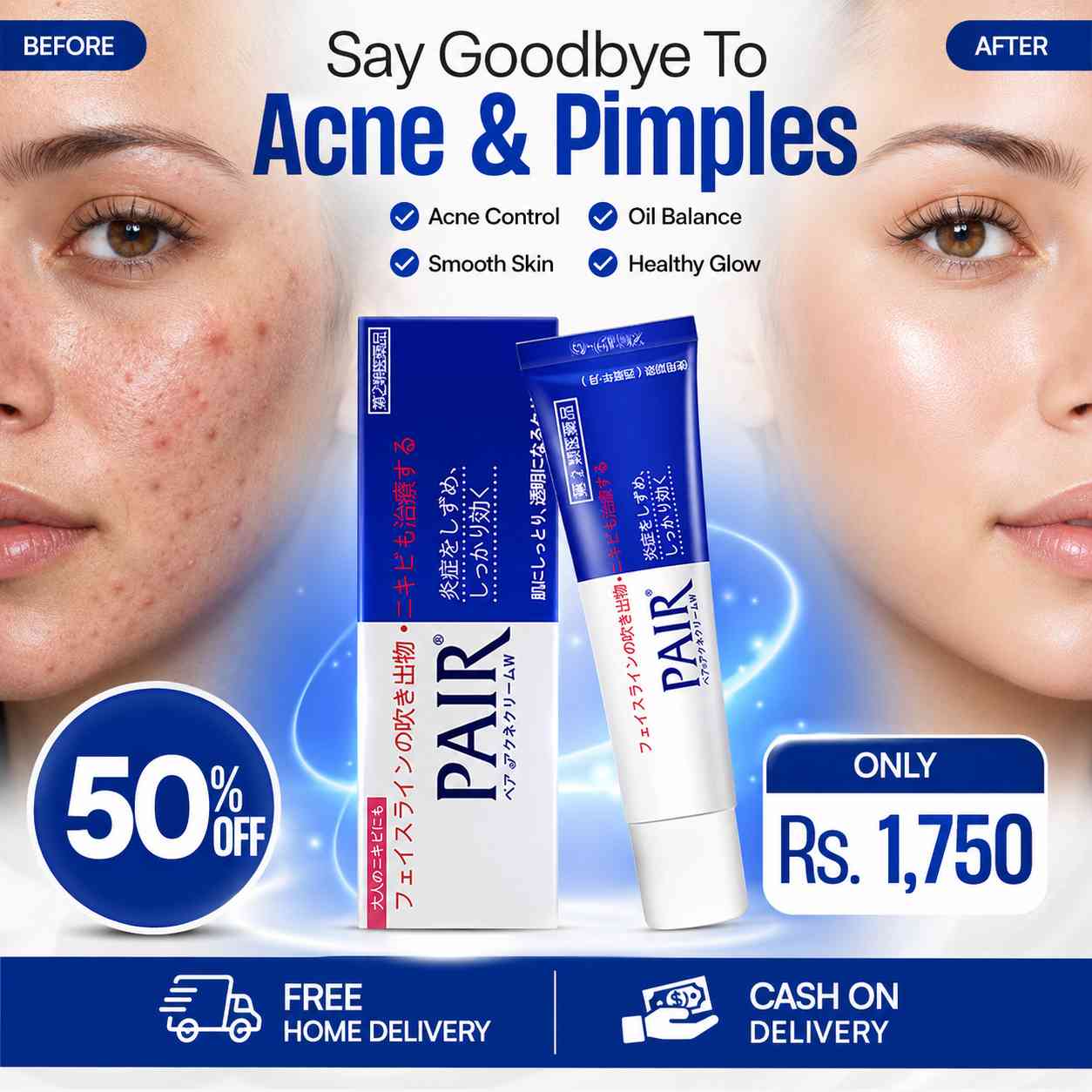 LION PAIR ACNE CREAM